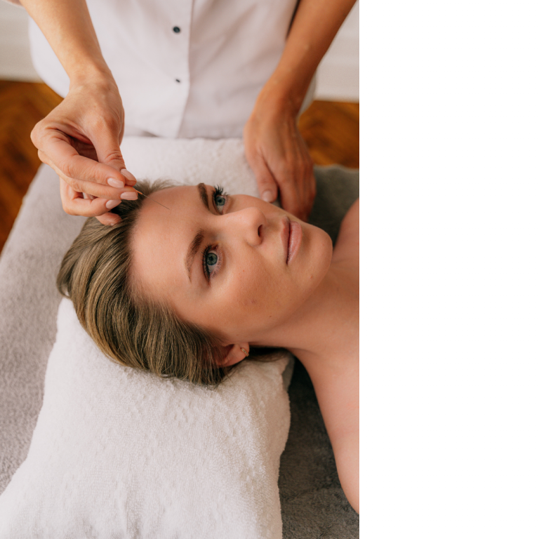 points d'acupuncture lors de séance d'aculift et points de longévité