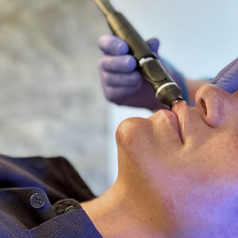 soin levre perk hydrafacial anglet