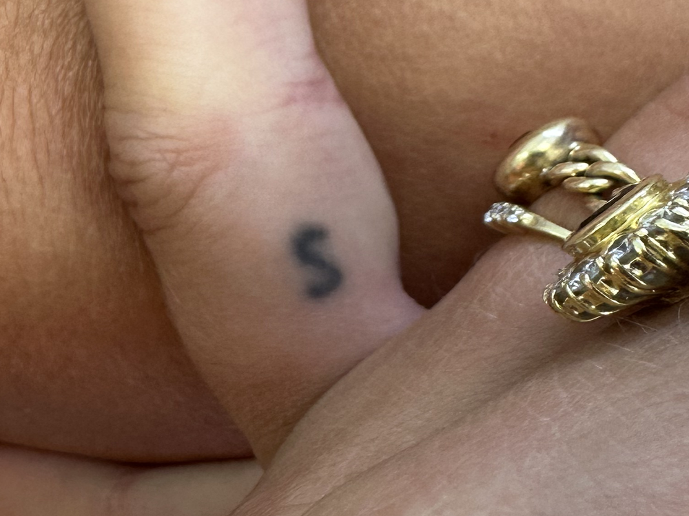 détatouage-anglet-avant