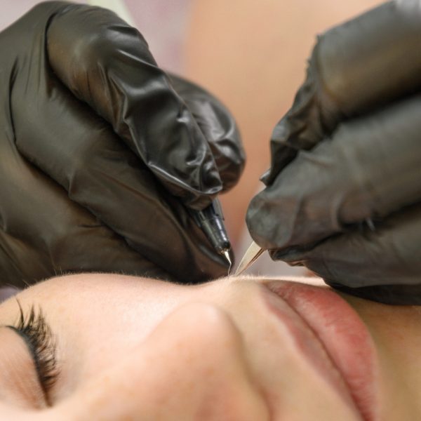 Épilation définitive par électrolyse médicale du visage à Anglet.